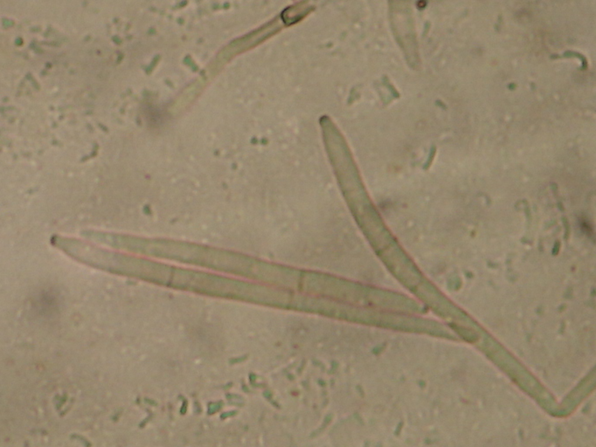 <p><b><p>Conídios de <em>M.fijiensis</em>, com cicatriz em sua base. </p></b></p><p>Autor: Josiane T. Ferrari</p>