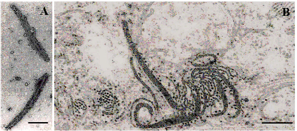 <p><b><p>Micrografia eletrônica de partículas alongadas e flexuosas com aproximadamente 720 nm de comprimento fortemente decoradas com antissoro específico contra o <em>Turnip mosaic virus </em>(TuMV); note um denso halo ao redor das partículas (A). Agregados laminares, e túbulos e cataventos são observados em corte ultrafino de mesófilo de raiz-forte infectada pelo TuMV (B). Barras = 200 nm. </p></b></p><p></p>