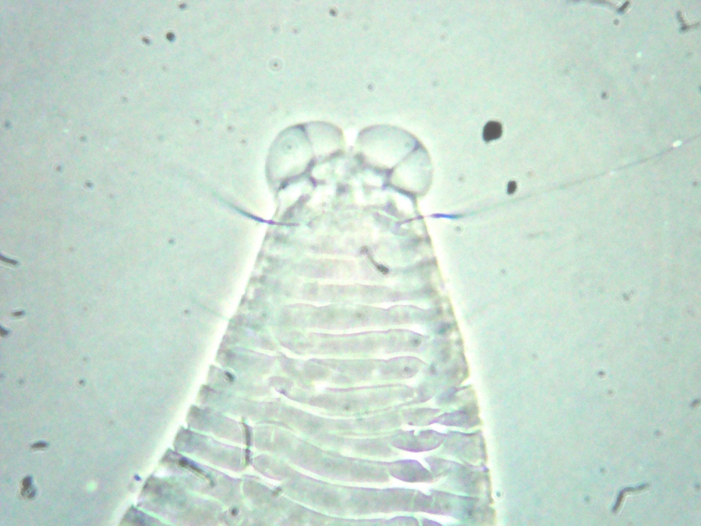 <p><b><p>Opistogaster de <em>Phyllocoptruta oleivora</em>, detalhes das setas h2, observada em montagem de lâmina permanente (meio Hoyer) aumento de 1000x.</p></b></p><p>Autor: André L. Matioli</p>