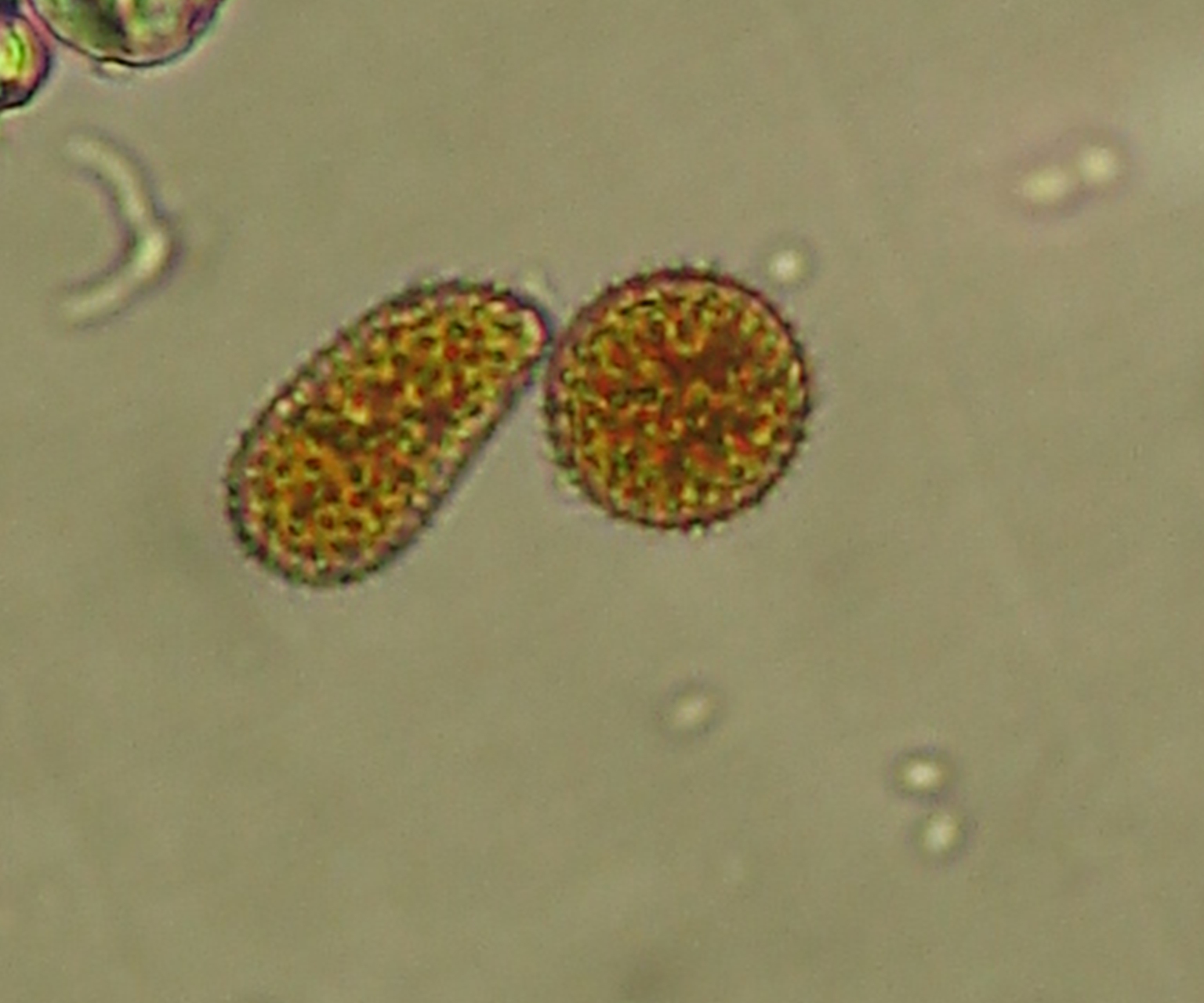<p><b><p>Urediniosporos de <em>Olivea tectonae.</em></p></b></p><p>Autor: Josiane T. Ferrari</p>