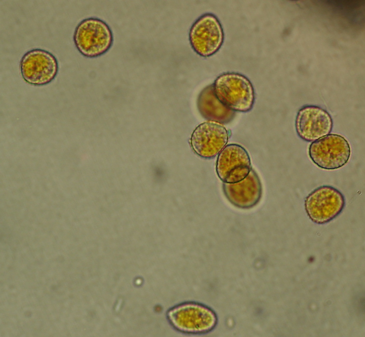 <p><b><p>Urediniosporos de <em>Olivea tectonae</em>.</p></b></p><p>Autor: Josiane T. Ferrari</p>
