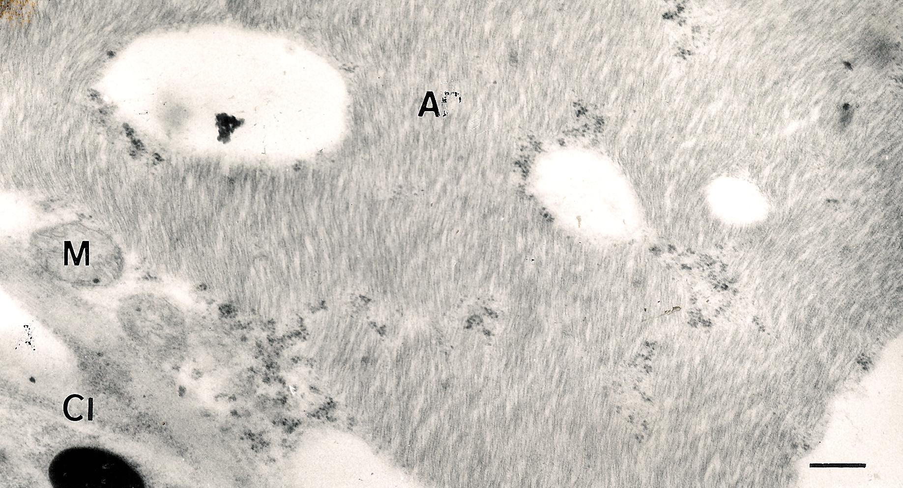 <p><b><h4>Micrografia eletrônica, em contraste negativo, de tecido de cladódio de Hylocereus undatus naturalmente infectada apresentando agregados de partículas virais alongadas (A) no citoplasma. M = mitocôndrio, Cl = cloroplasto. Barra = 500nm </h4></b></p><p>Autor: Silvia R. Galleti</p>