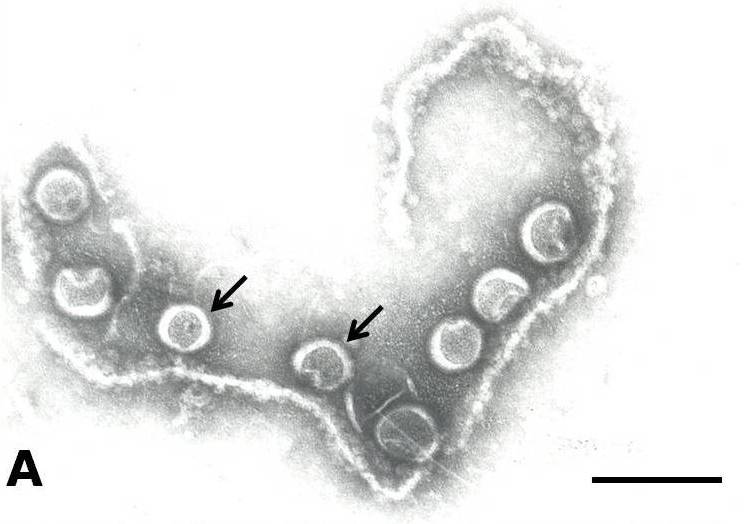 <p><b><p>Micrografia eletrônica do <em>Tomato chlorotic spot virus </em>(TCSV) contrastado negativamente. Notam-se partículas contidas em presumível remanescente do retículo endoplasmático </p></b></p><p></p>
