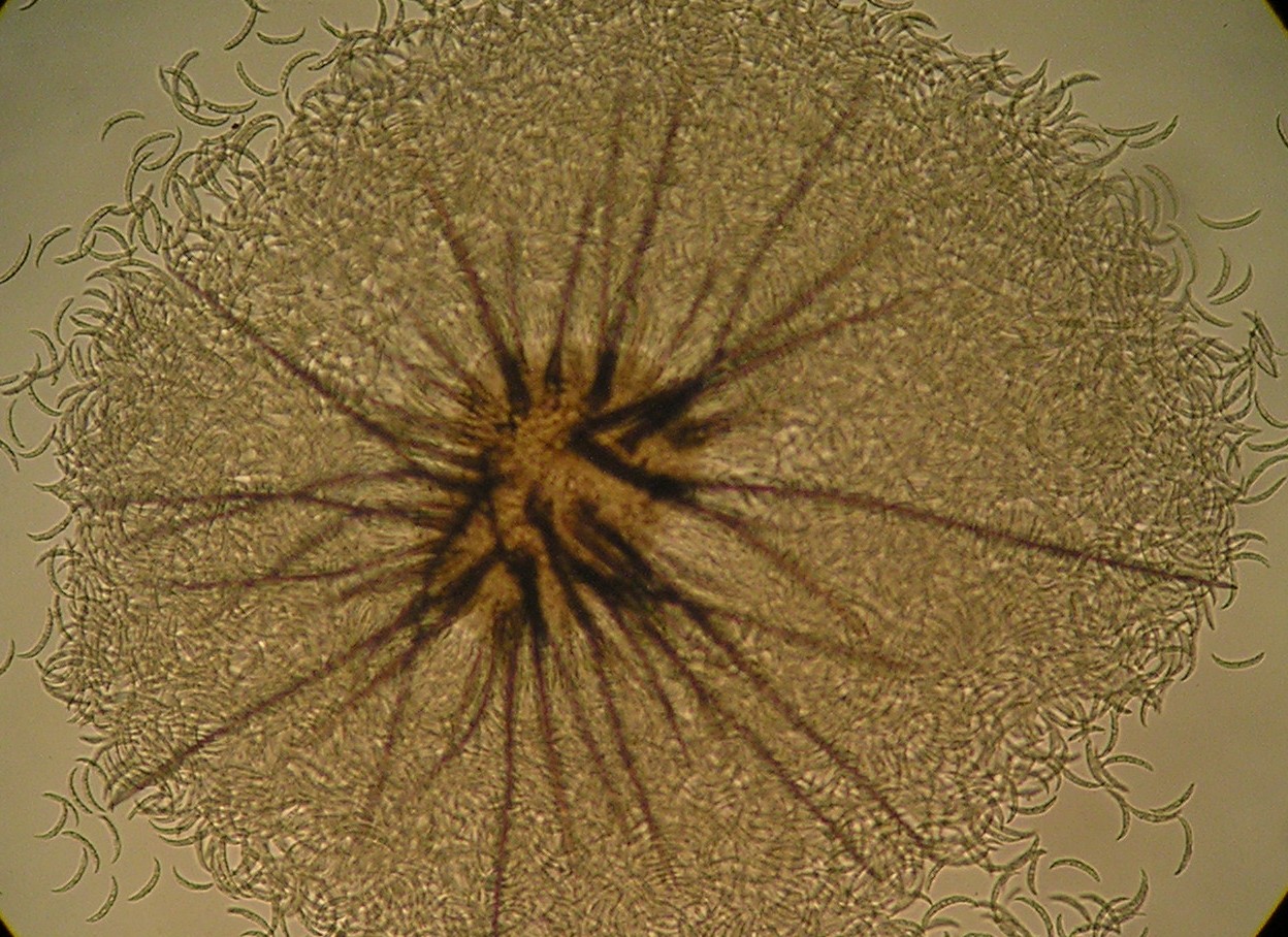 <p><b><h4>Detalhes dos conídios e setas de <em>Colletotrichum falcatum <br /></em>observados em microscopia óptica (aum. 400X).</h4></b></p><p>Autor: O.M.R.Russomanno</p>