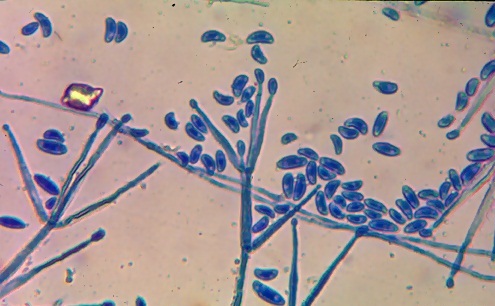 <p><b><p>Conidióforos e conídios de <em>Verticillium fungicola</em>, sob microscopia ótica.</p></b></p><p>Autor: Leila N.Coutinho</p>