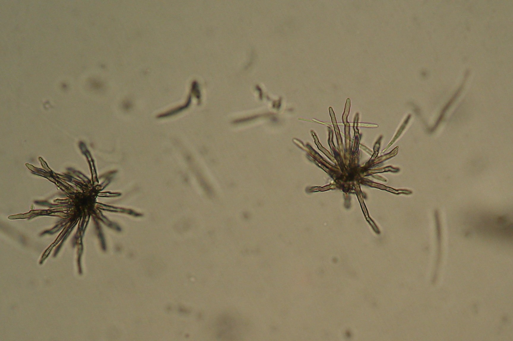 <p><b><p>Conidióforos de <em>Cercospora longipes</em> visualizados sob microscópio óptico.</p></b></p><p>Autor: Josiane T. Ferrari</p>