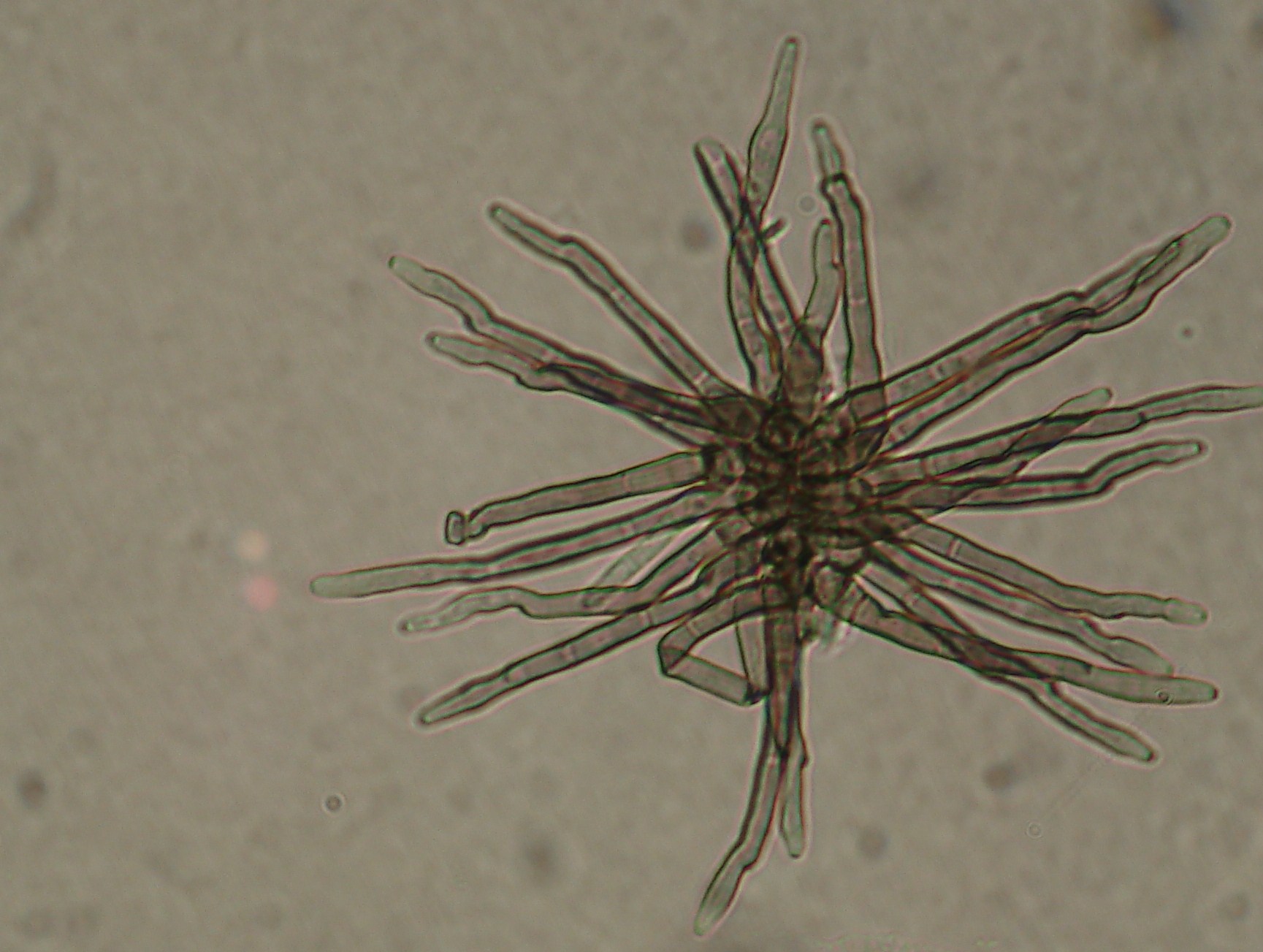 <p><b><p>Conidióforos de <em>Cercospora longipes</em> visualizados sob microscópio óptico.</p></b></p><p>Autor: Josiane T. Ferrari</p>