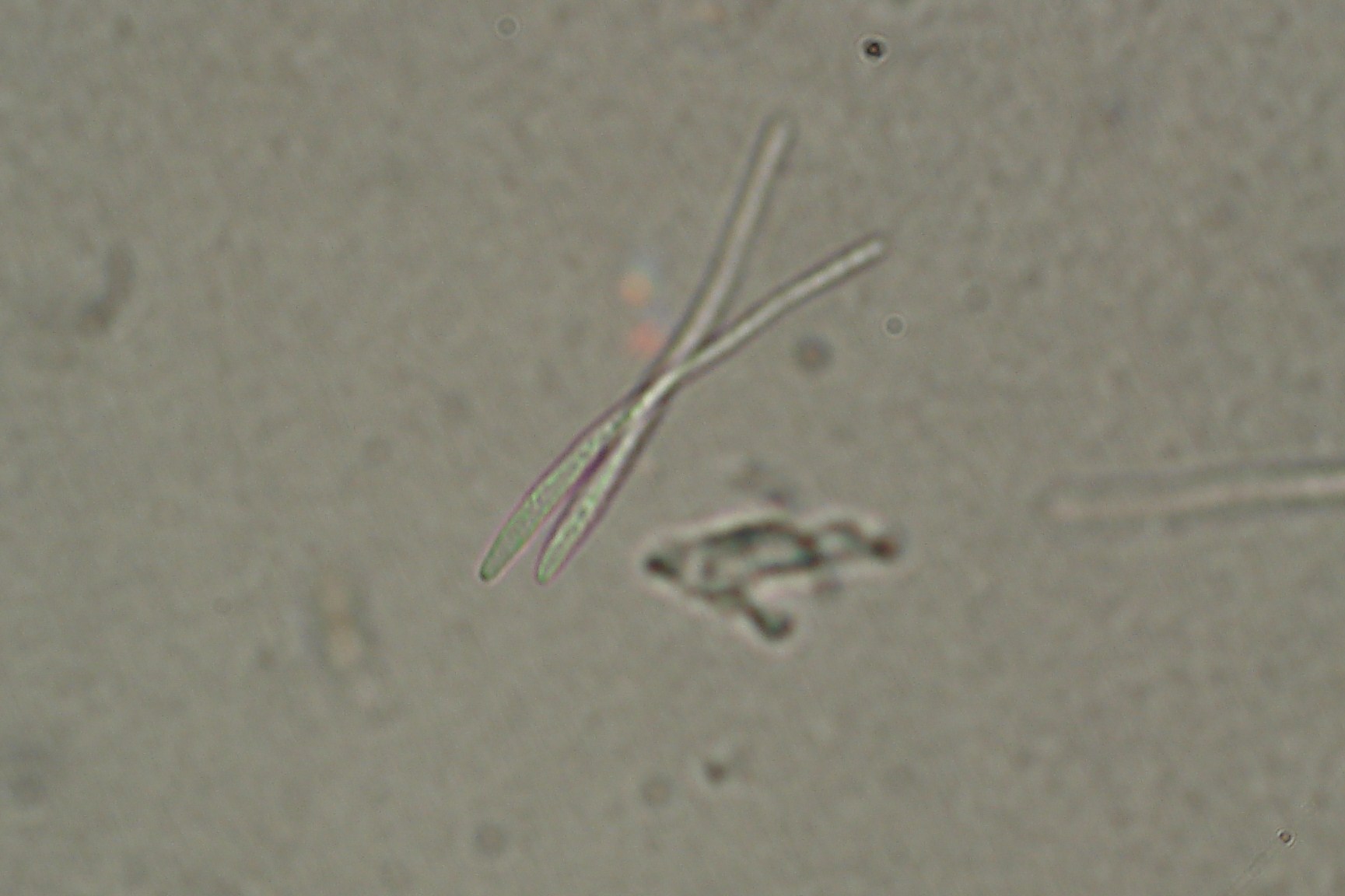 <p><b><p>Conídios de <em>Cercospora longipes</em> visualizados sob microscópio óptico.</p></b></p><p>Autor: Josiane T. Ferrari</p>