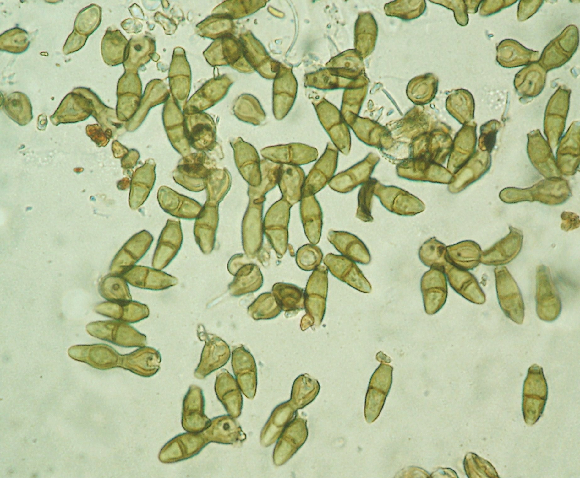 <p><b><p>Conídios de <em>F.oleagineum</em> vistos ao microscópio óptico.</p></b></p><p>Autor: Ricardo J. Domingues</p>