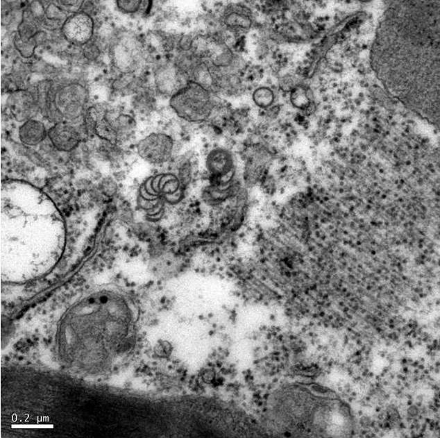 <p><b><p>Micrografia eletrônica de corte ultrafino de folha de pepino silvestre (<em>Melothria </em>spp., Cucurbitaceae) infectado pelo ZYMV, mostrando cata-ventos (inclusões induzidas pelo vírus) no citoplasma da célula. </p></b></p><p>Autor: Francisco A.O. Tanaka</p>