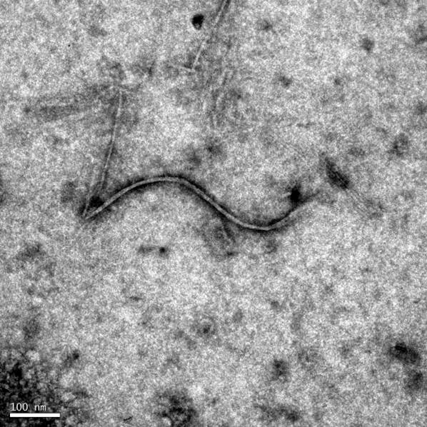 <p><b><p>Micrografia eletrônica obtida de preparação rápida de extrato de folha (<em>leafdip</em>) de couve-brócolo (<em>B. oleracea</em> var. <em>italica</em>) infectada pelo TuMV. Observa-se uma partícula alongada flexuosa com cerca de 750 nm de comprimento, típica do gênero Potyvirus. </p></b></p><p>Autor: Elliot Watanabe Kitajima</p>