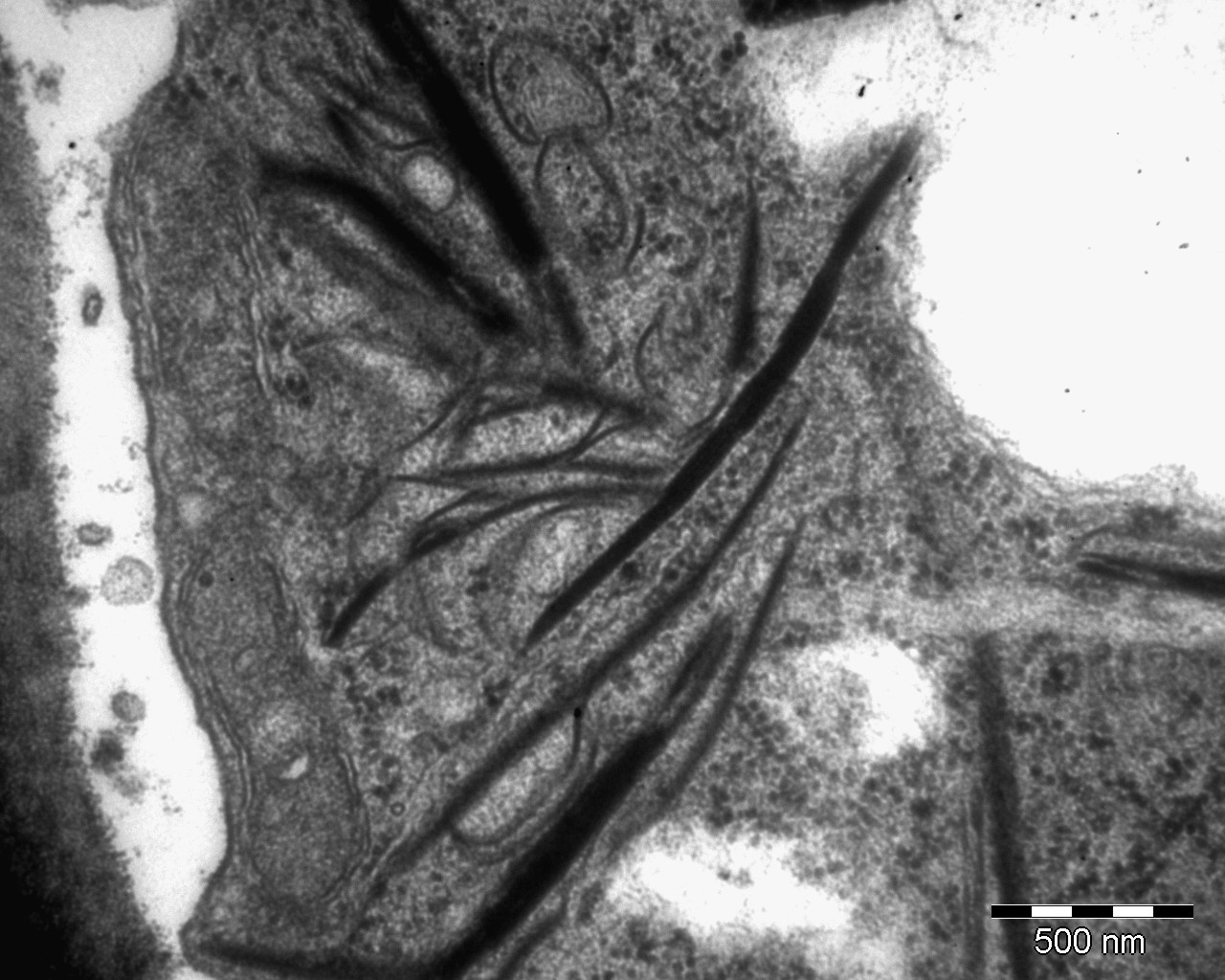 <p><b><p>Micrografia eletrônica de corte ultrafino de folha de zamioculca infectada por KoMV mostrando inclusões típicas induzidas pelo vírus.</p></b></p><p> Autor: E. W. Kitajima</p>