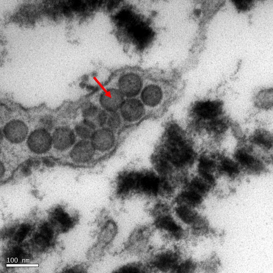 <p><b><p>Micrografia eletrônica de partículas de <em>Tomato spotted wilt virus </em>(TSWV), em corte ultrafino de folha de <em>Eucharis grandiflora </em>(lírio-do-Amazonas) naturalmente infectada.</p></b></p><p>Autor: E. W. Kitajima</p>
