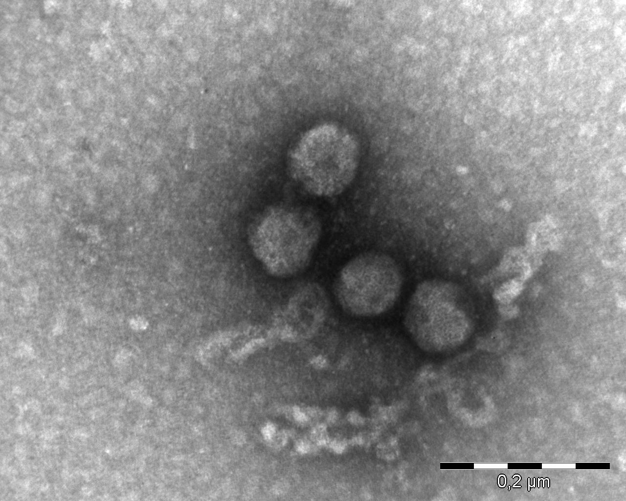 <p><b><p>Micrografia eletrônica de folhas de <em>Eustoma grandiflorum</em>, naturalmente infectada, mostrando partículas de tospovirus.</p></b></p><p>Autor: E.W. Kitajima</p>