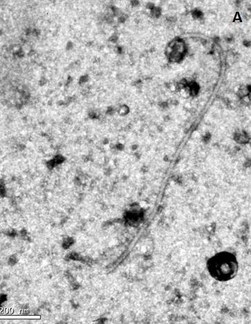 <p><b><p>Micrografia eletrônica mostrando partícula viral alongado-flexuosa, negativamente corada com acetato de uranila.</p></b></p><p>Autor: E.W. Kitajima</p>