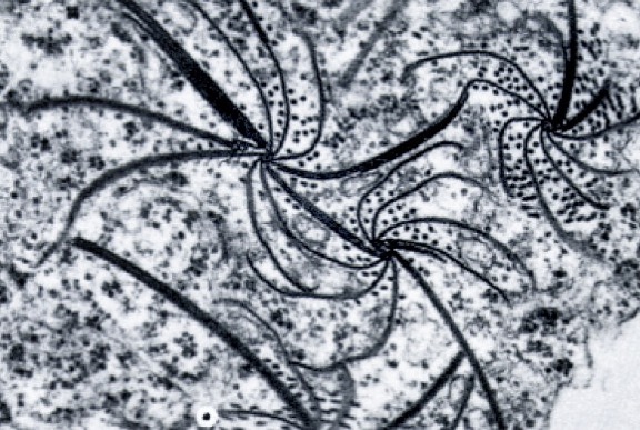 <p><b><p>Inclusões do tipo catavento visualizados em microscópio eletrônico em plantas de <em>S.nigrum </em>com PVY. </p></b></p><p>Autor: </p>