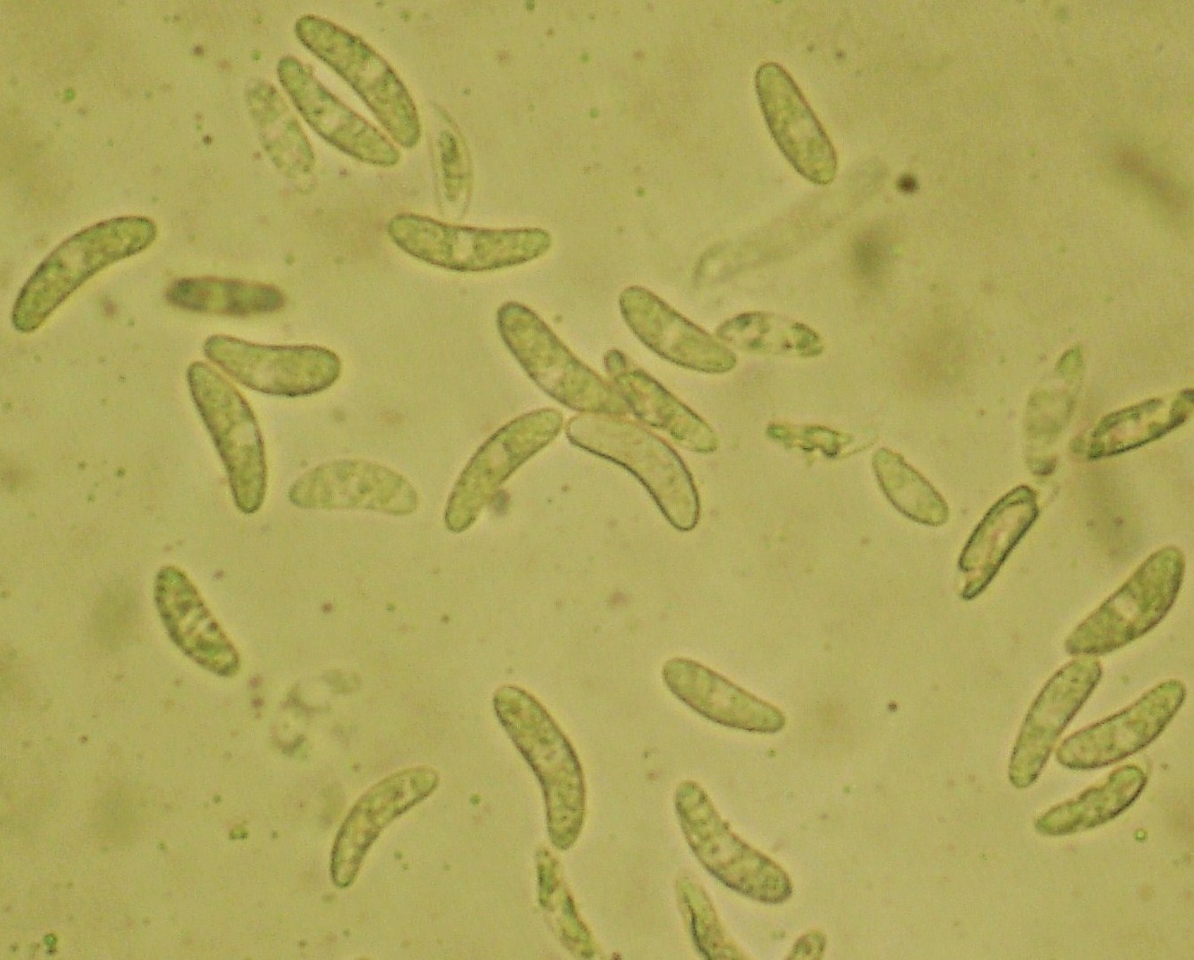 <p><b><p>Conídios de <em>Colletotrichum coccodes</em>.</p></b></p><p>Autor: Jesus G. Töfoli</p>