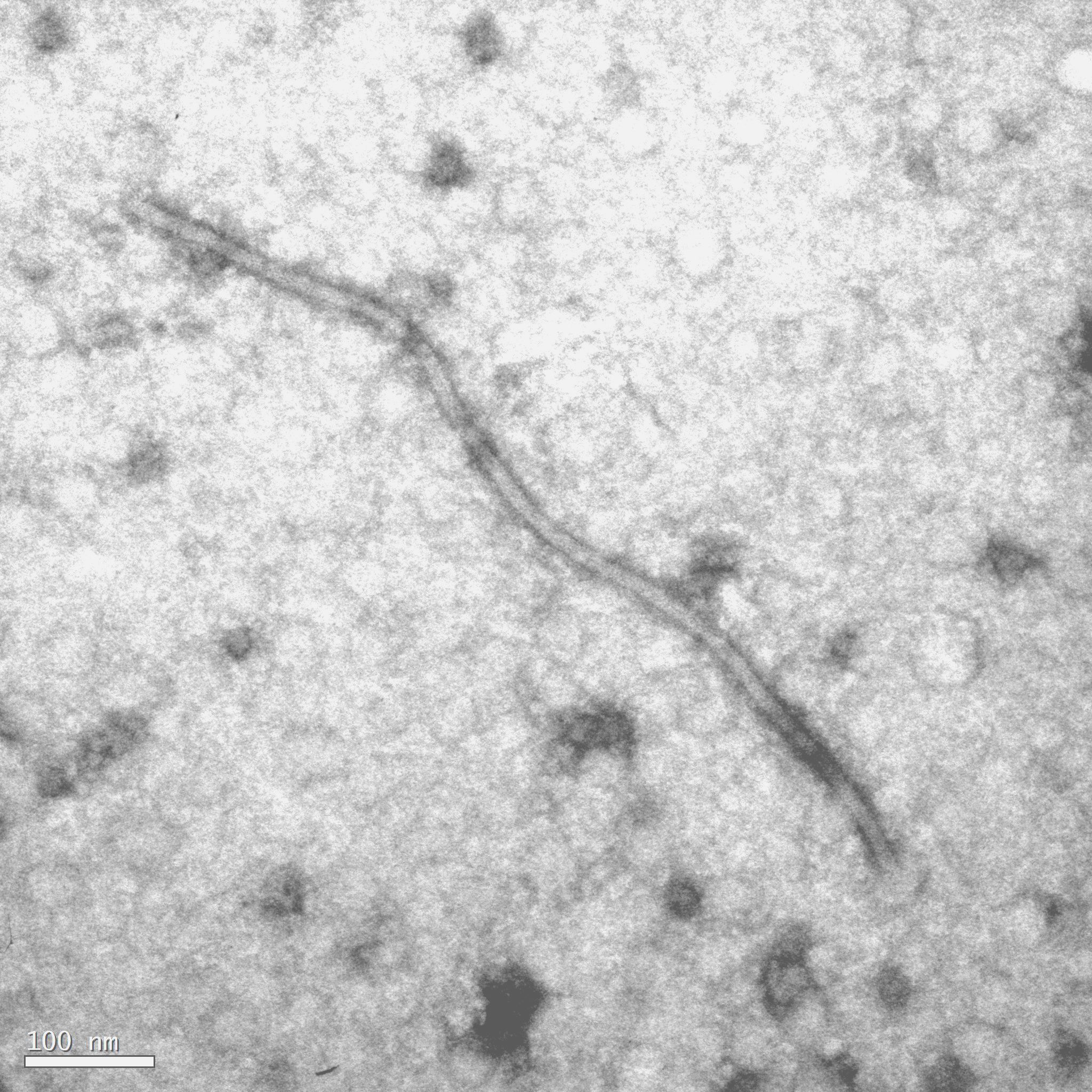 <p><b><p>Micrografia eletrônica a partir de preparação de extrato de flor (leaf-dip) de gloriosa, mostrando partícula viral alongado-flexuosa com cerca de 800 nm de comprimento. </p></b></p><p>Autor: E.W. Kitajima</p>