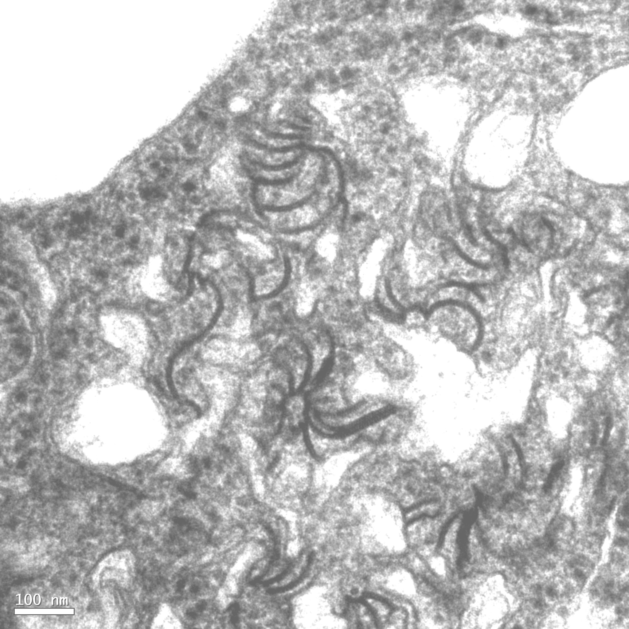 <p><b><p>Secções ultra-finas de folhas de gloriosa, naturalmente infectada, mostrando inclusões lamelares (LI) e alguns cata-ventos (“pinheels”) típicos de infecção causada por <em>Potyvirus</em>.</p></b></p><p>Autor: E.W. Kitajima</p>