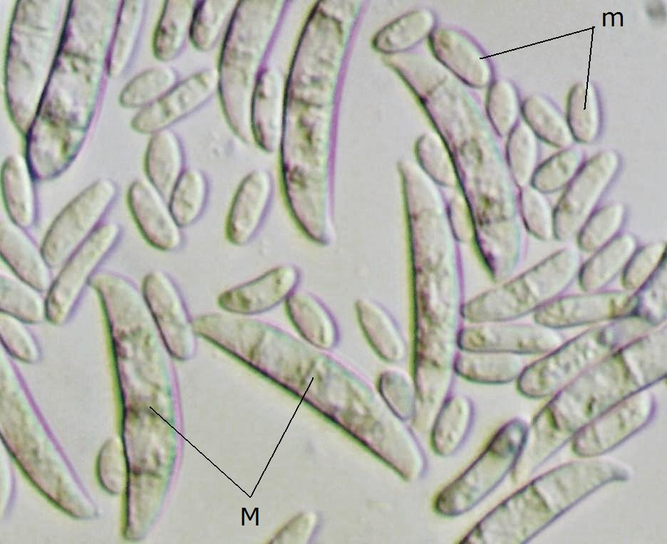 <p><b>Macro (M) and microconidia (m) of Fusarium oxysporum f.sp. lactucae</b></p><p>Autor: Ricardo J. Domingues.</p>