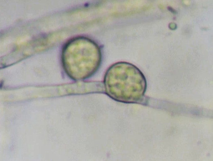 <p><b>Chlamydospores: Resistance structures that can perpetuate the pathogen in the soil for long periods.</b></p><p>Autor: Ricardo J. Domingues.</p>