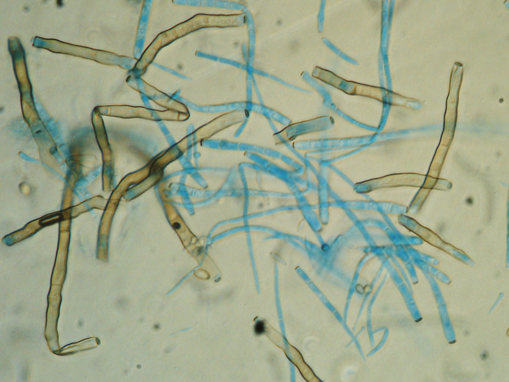 <p><b>Conídios e conidióforos de Cercospora sp. vistos ao microscópio óptico</b></p><p>Ricardo J. Domingues</p>