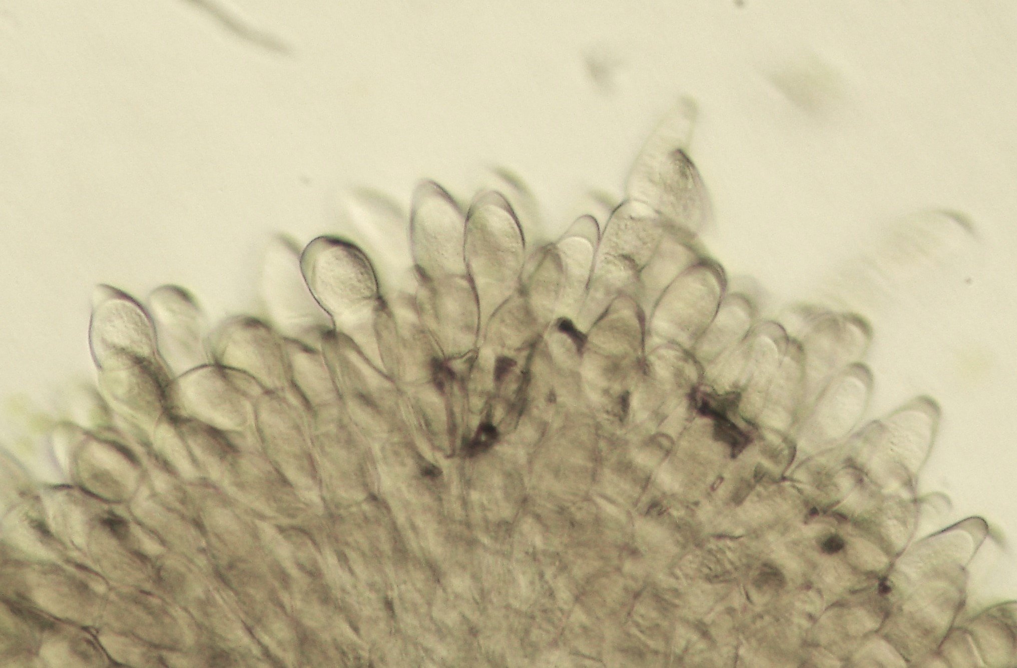 <p><b>Pústula de P. horiana vista ao microscópio óptico.</b></p><p>Autor: Ricardo José Domingues</p>